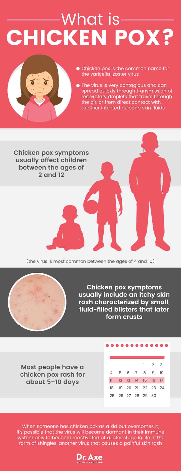 Chicken pox symptoms: What is chicken pox? - Dr. Axe