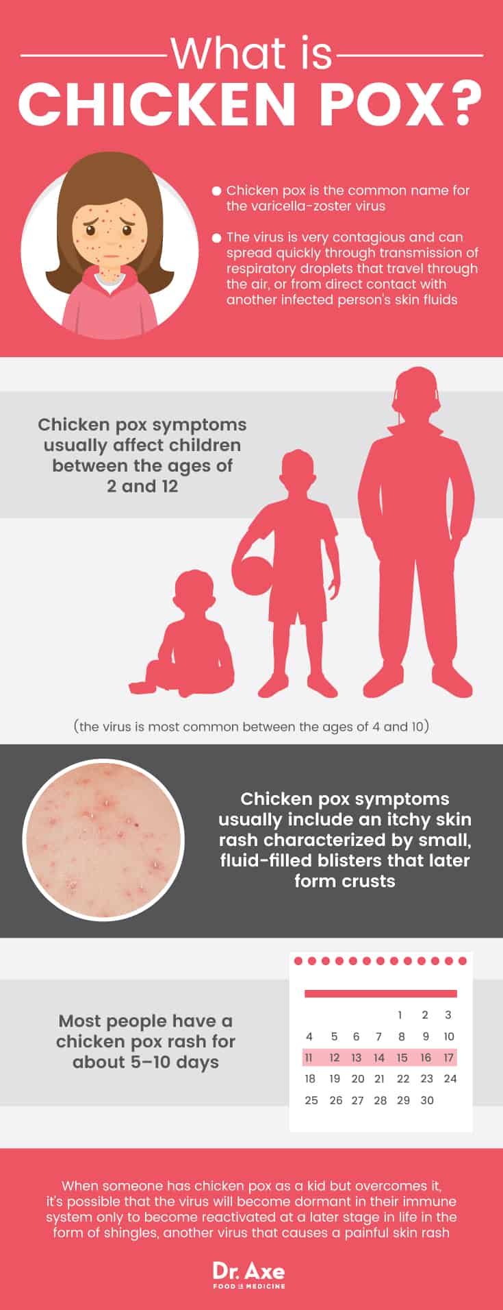 Adult Chicken Pox Stages