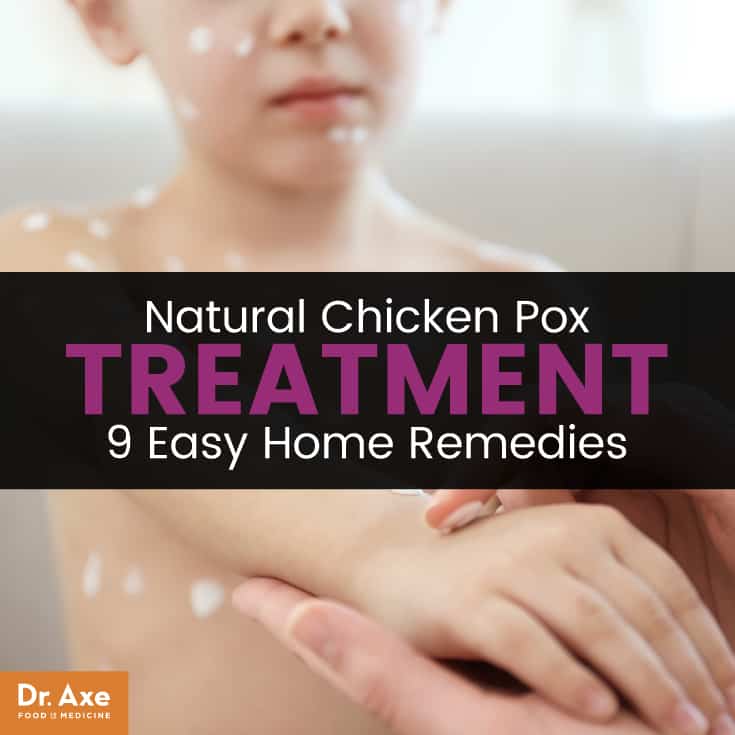 Chicken pox treatment - Dr. Axe
