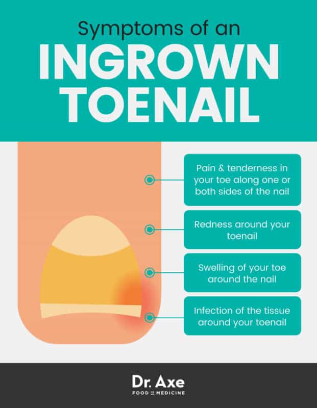 How to Get Rid of an Ingrown Toenail Removal and Remedies Dr. Axe