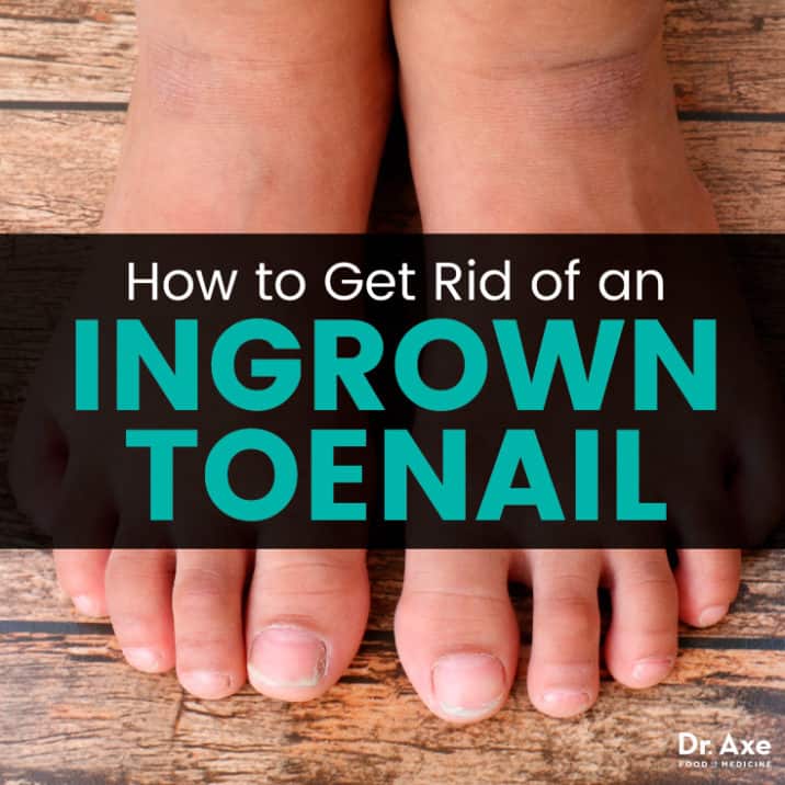 How To Get Rid Of An Ingrown Toenail Removal And Remedies Dr Axe 