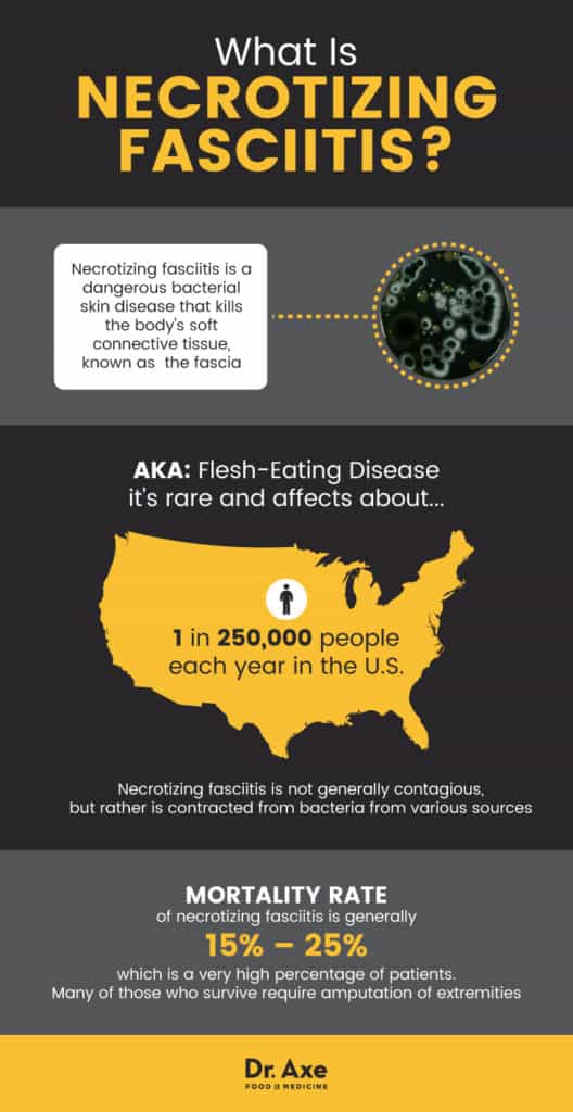 Necrotizing Fasciitis: Avoid This 'Flesh-Eating' Disease - Dr. Axe