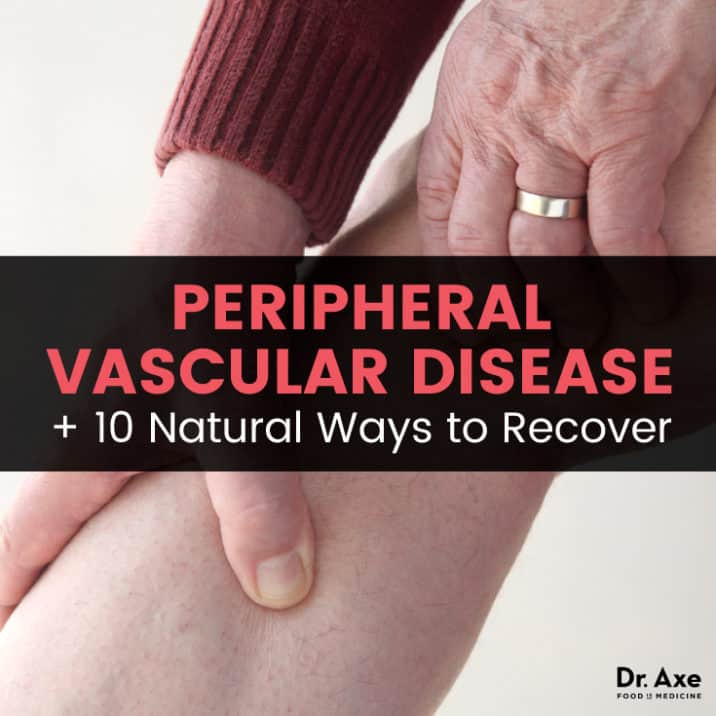 Peripheral Vascular Disease Causes + 10 Natural Treatments - Dr. Axe