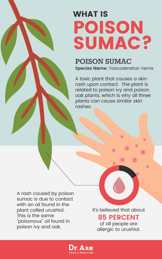 Poison Sumac Symptoms + 5 Natural Treatments Dr. Axe