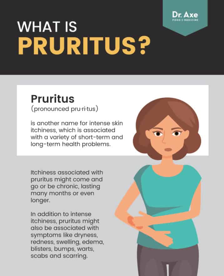 Pruritus: Causes & Risk Factors + 5 Natural Treatments - Dr. Axe