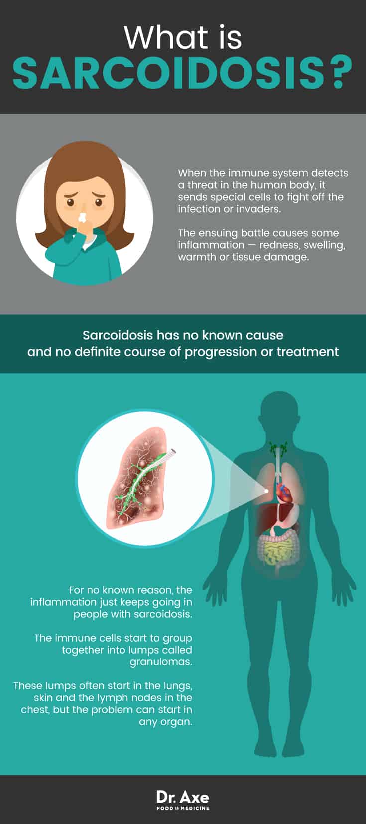 What is sarcoidosis? - Dr. Axe