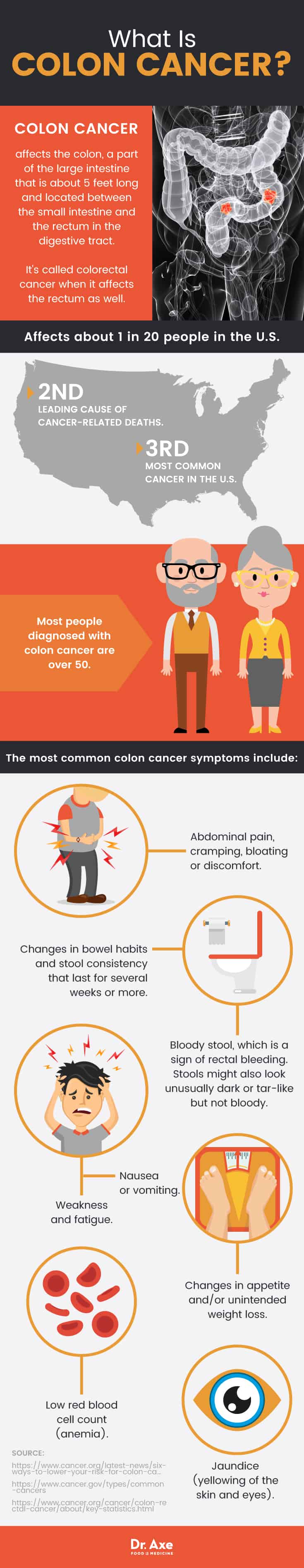 Colon cancer symptoms: what is colon cancer?