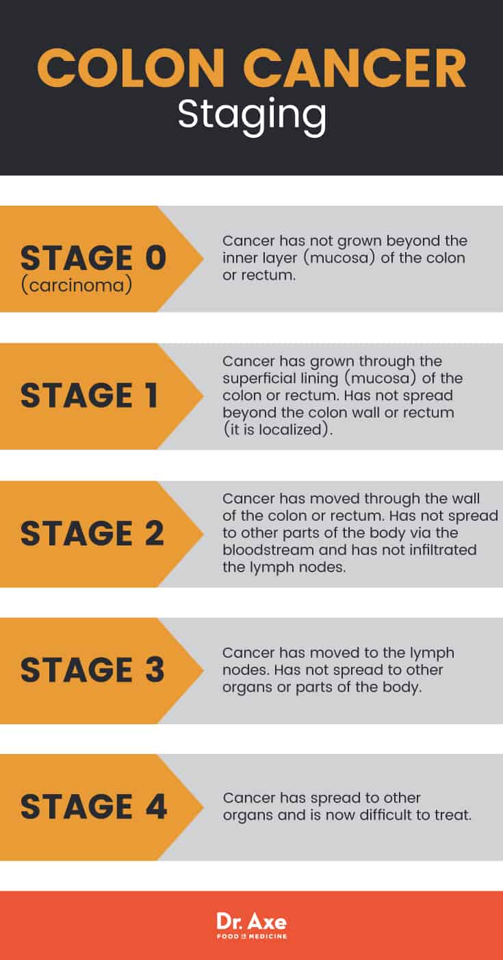 Colon cancer symptoms: colon cancer staging