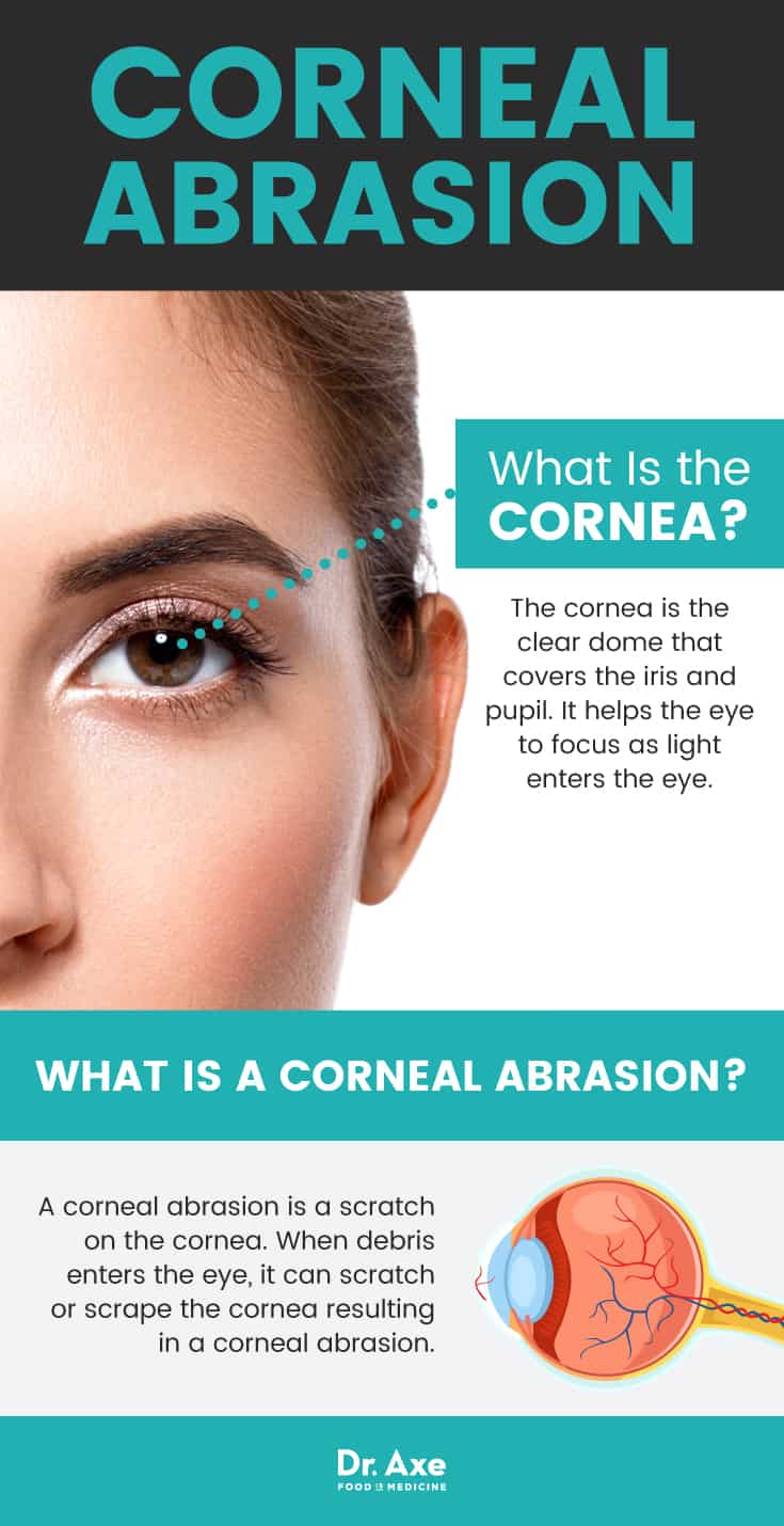 What is a corneal abrasion? - Dr. Axe