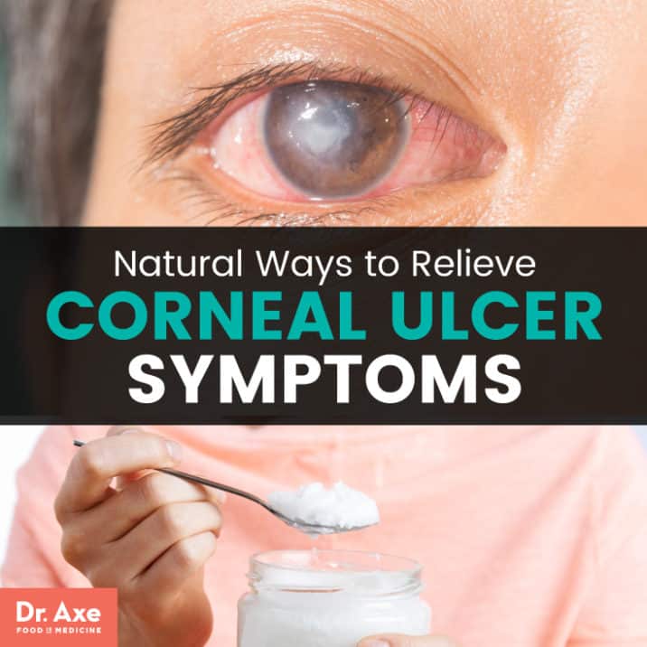 Corneal Ulcer Symptoms + Relieve Symptoms 11 Natural Ways - Dr. Axe