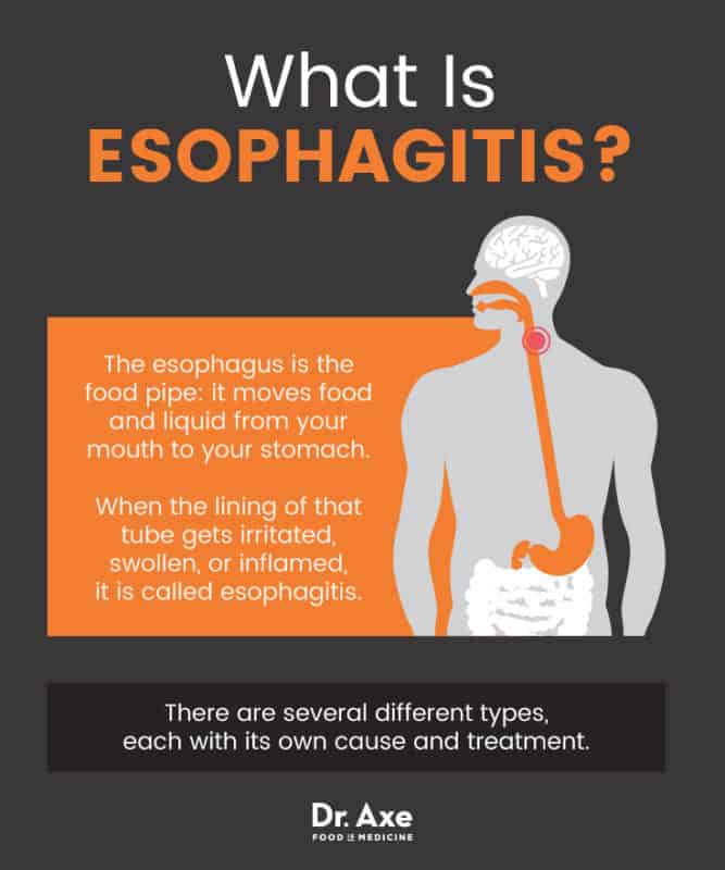 Esophagitis Causes, Symptoms & Natural SelfCare Dr. Axe