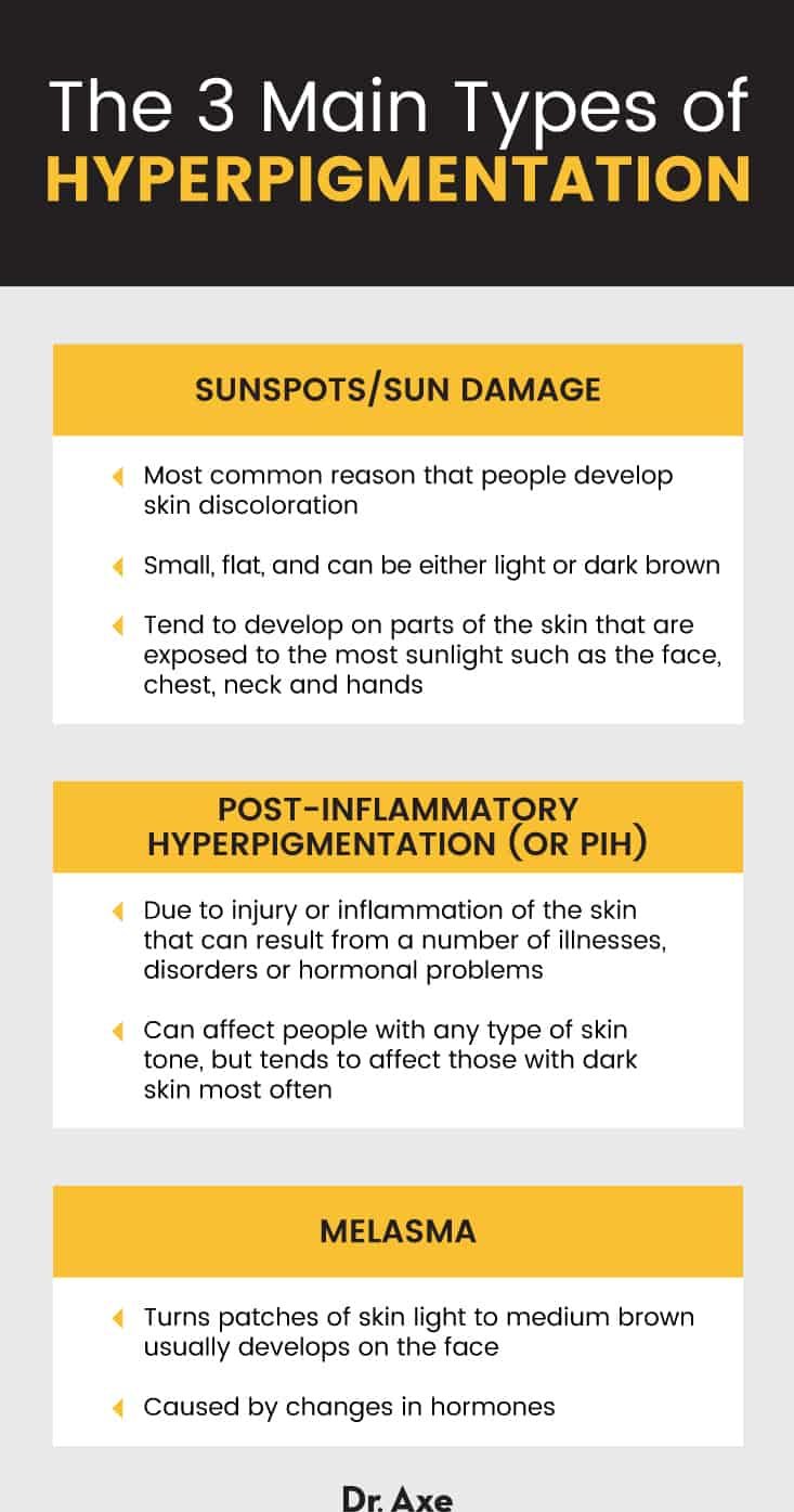 3 Main Types of Hyperpigmentation - Dr. Axe