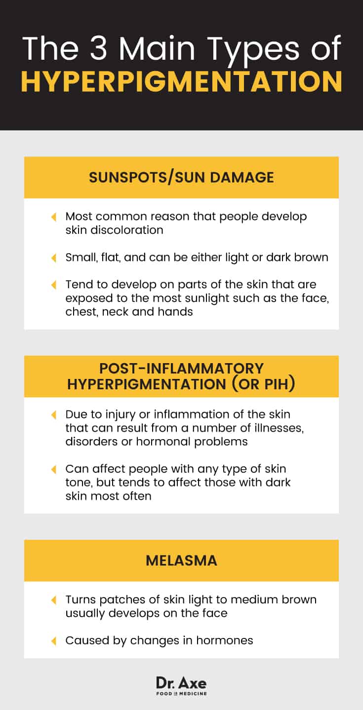 3 Main Types of Hyperpigmentation - Dr. Axe