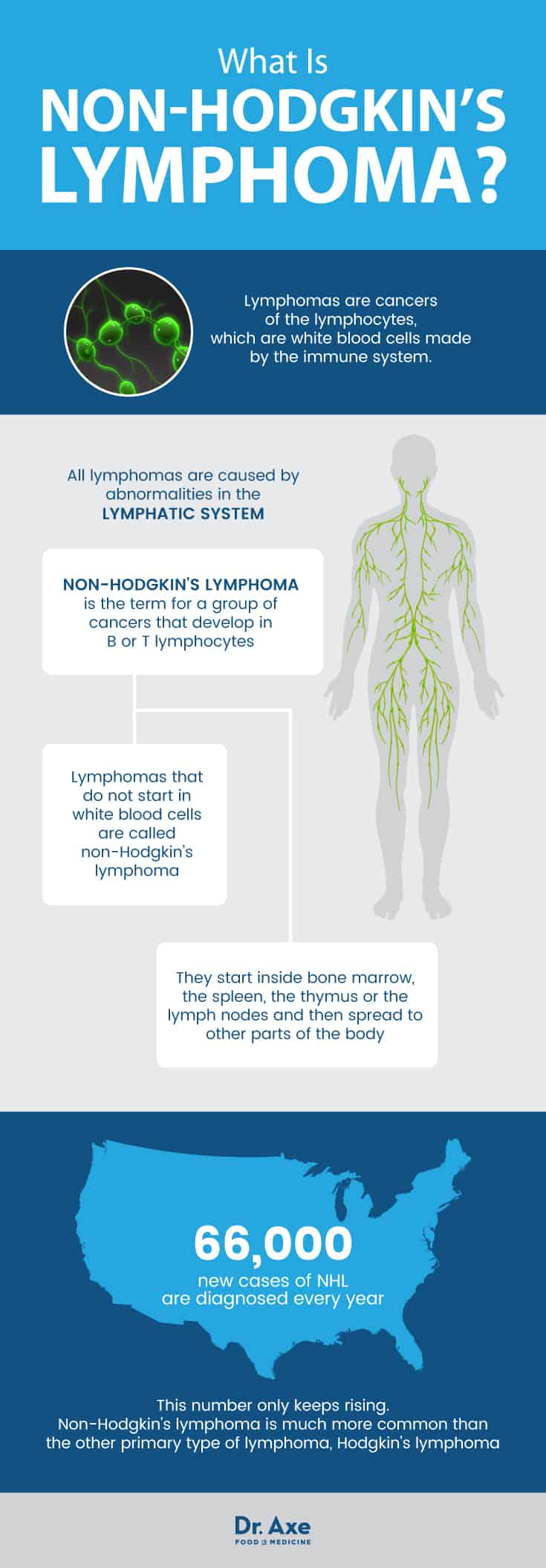 What is non-Hodgkins lymphoma? - Dr. Axe