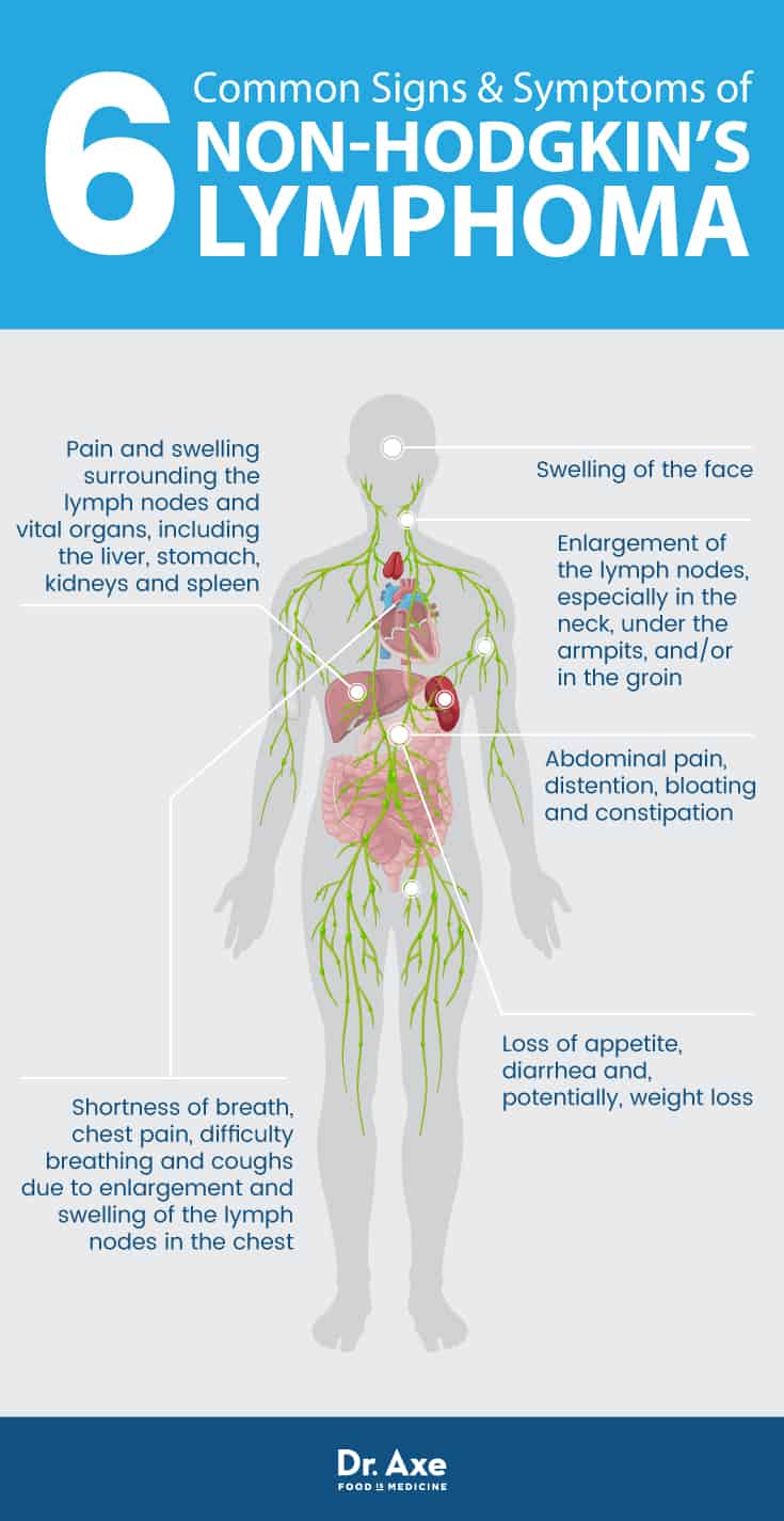 6 non-Hodgkins lymphoma symptoms - Dr. Axe