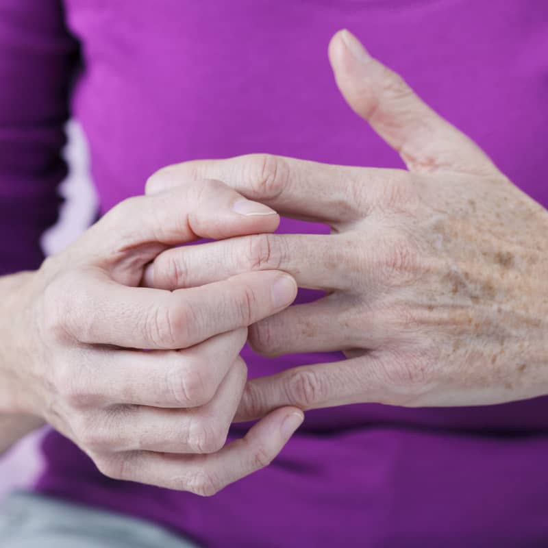 Psoriatic Arthritis: 7 Natural Ways to Relieve Symptoms - Dr. Axe