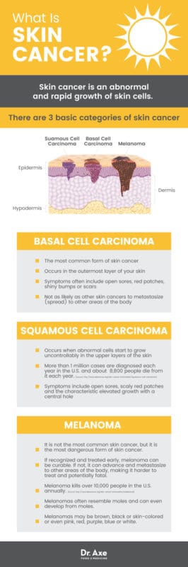 Skin Cancer Symptoms, Prevention & Natural Therapies - Dr. Axe