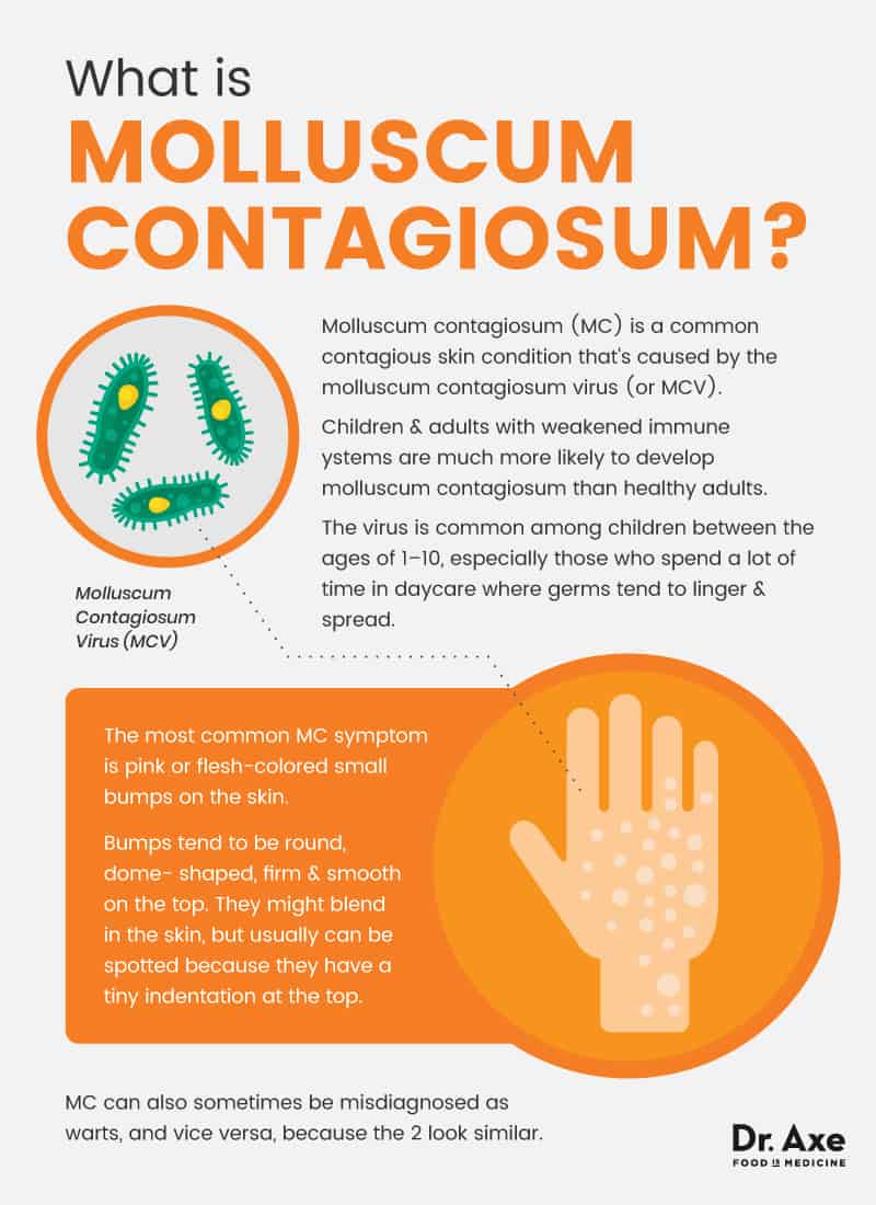 molluscum contagiosum treat warts contagious itchy draxe