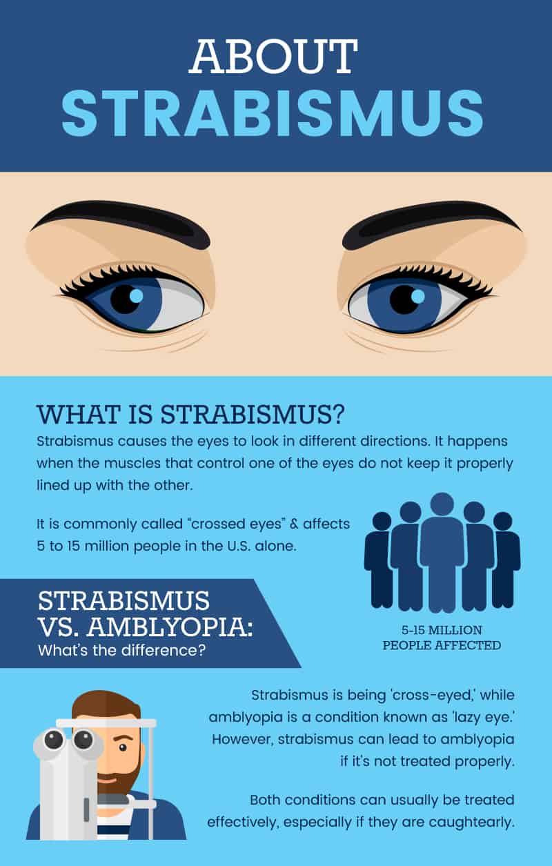 Esotropia (cross-eyed) and its causes and symptoms