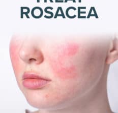 Rosacea treatment - Dr. Axe