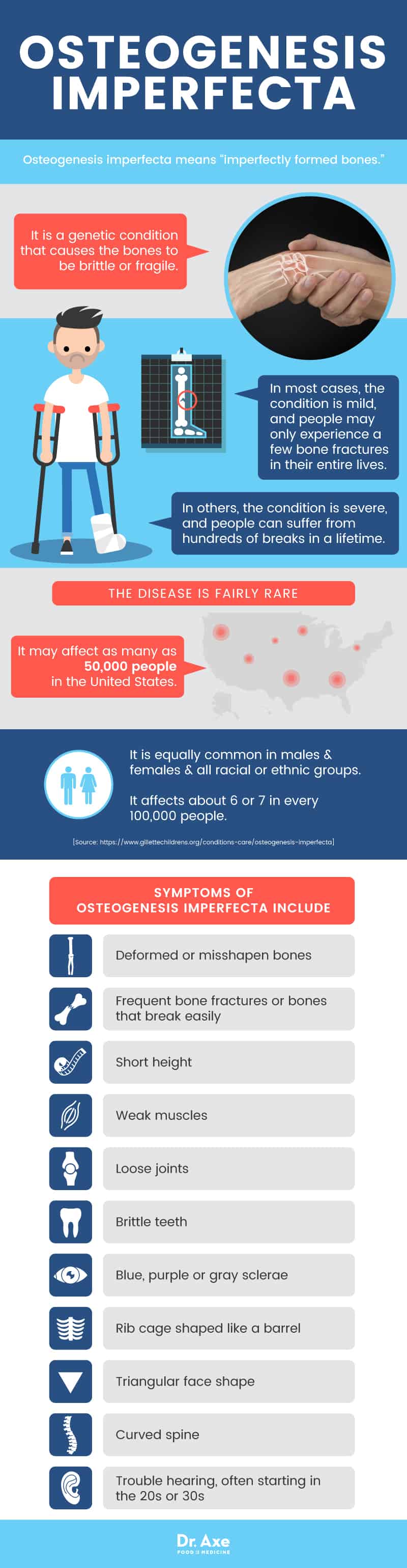 Osteogenesis imperfecta facts - Dr. Axe
