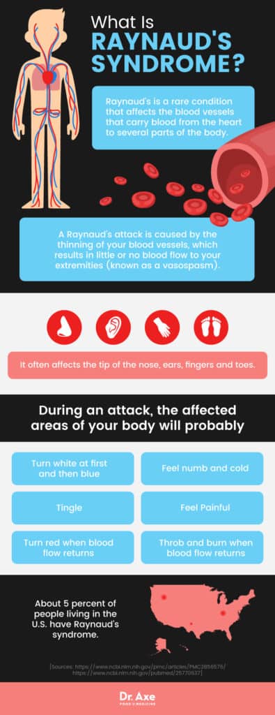 Raynaud's Syndrome + 6 Ways to Manage Symptoms - Dr. Axe