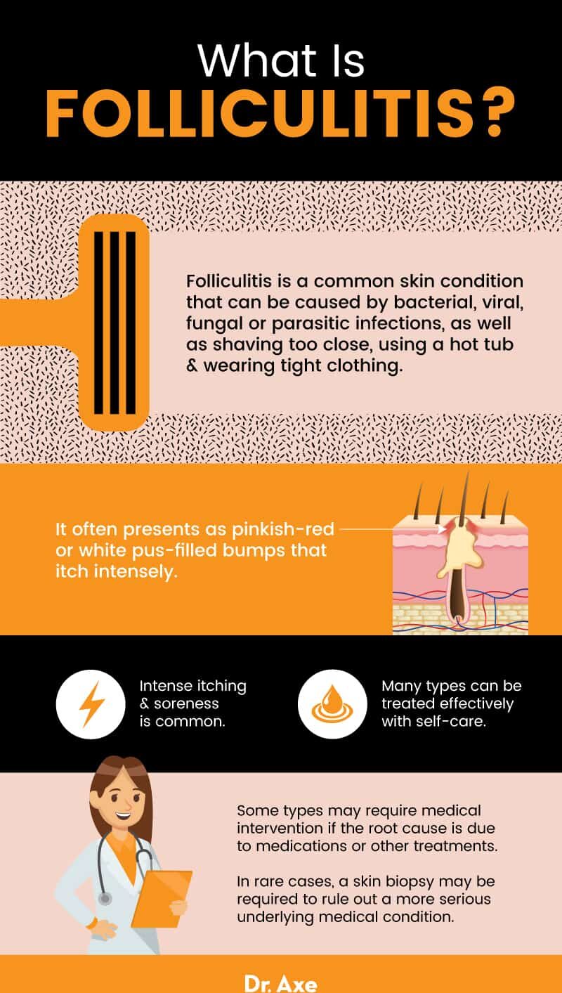 What is folliculitis? - Dr. Axe