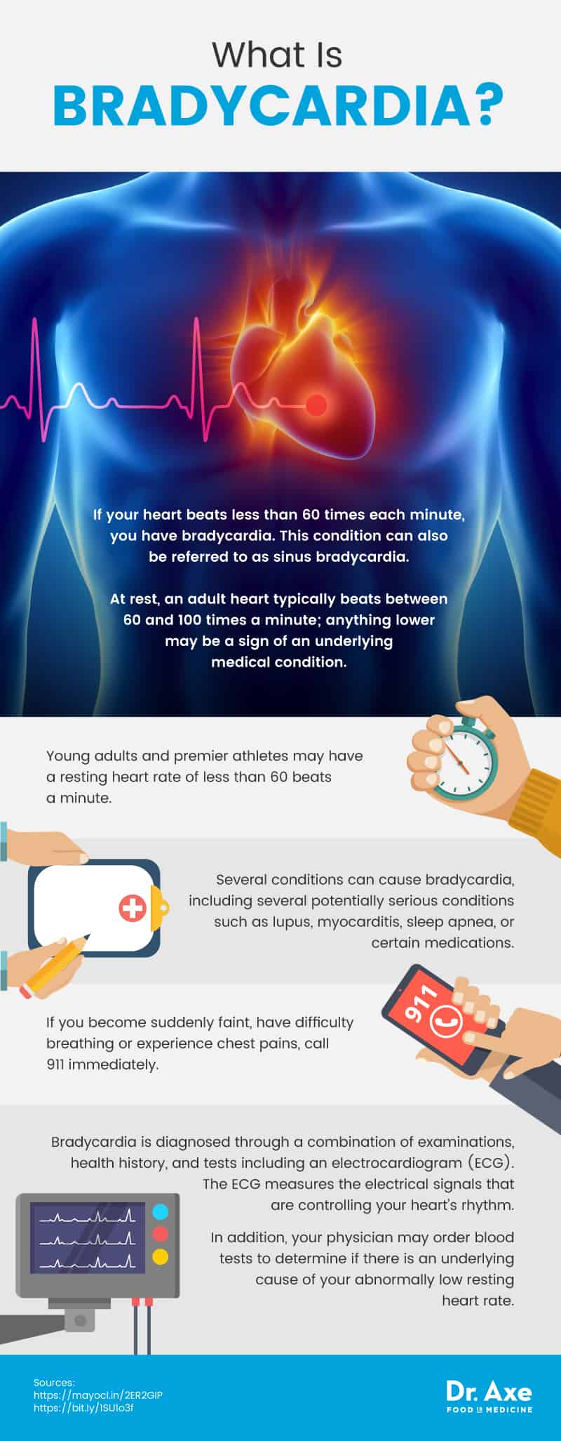 heart rhythm bradycardia