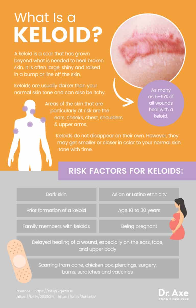 Keloid Causes (+5 Natural Tips to Help Treat Keloids) Dr. Axe