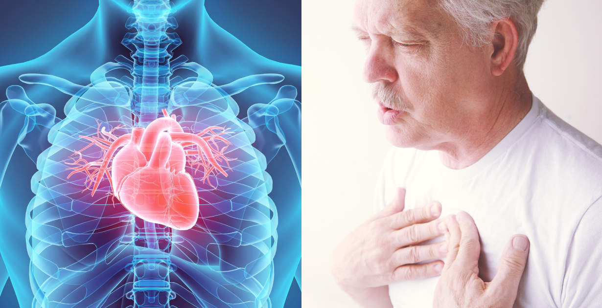 Myocarditis