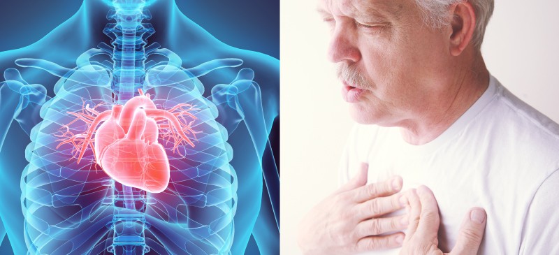 Myocarditis Causes + 6 Natural Ways to Help Manage It - Dr. Axe