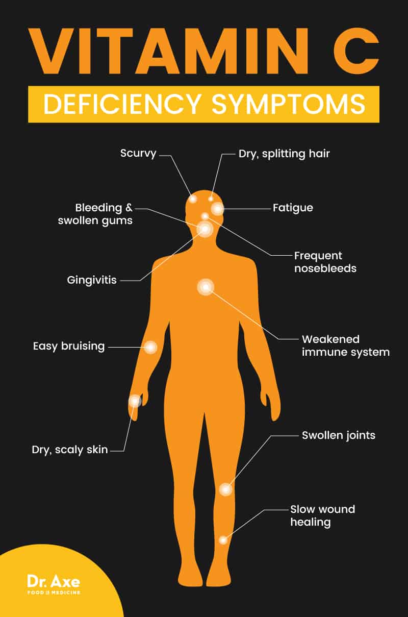 Vitamin C deficiency - Dr. Axe