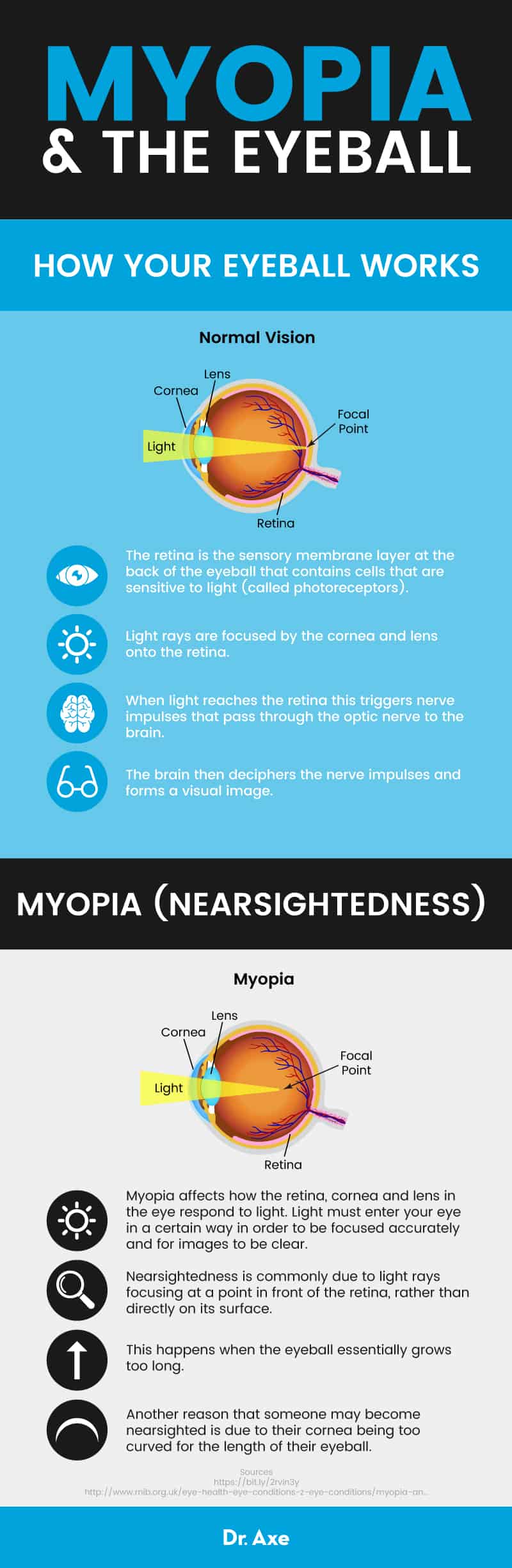 Myopia & the eyeball - Dr. Axe