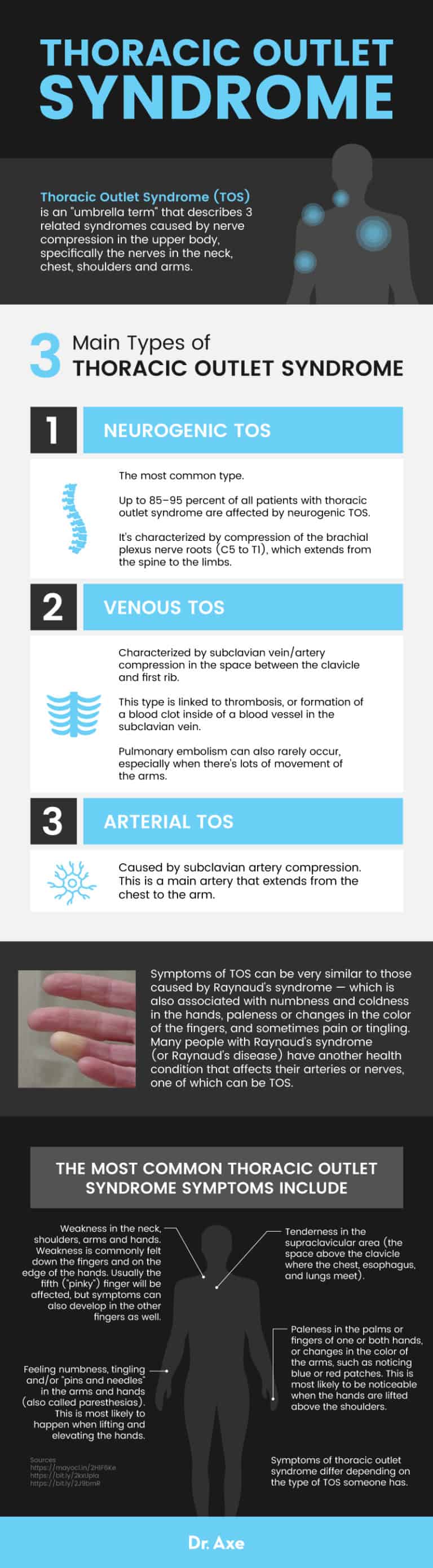 Thoracic Outlet Syndrome: 8 Stretches & Exercises to Help TOS - Dr. Axe