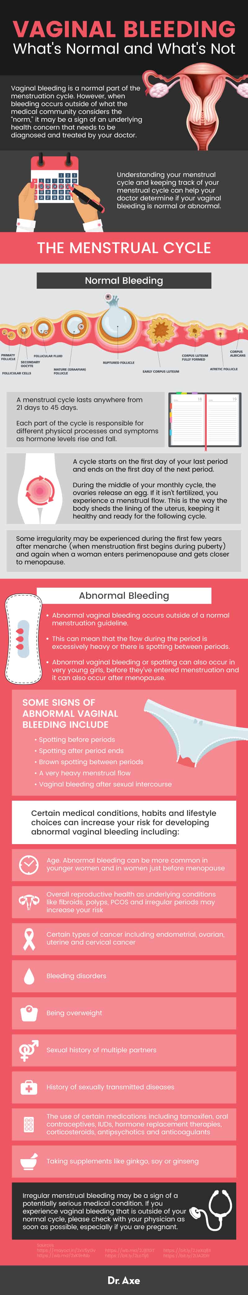 Vaginal bleeding: what's normal and what's not - Dr. Axe