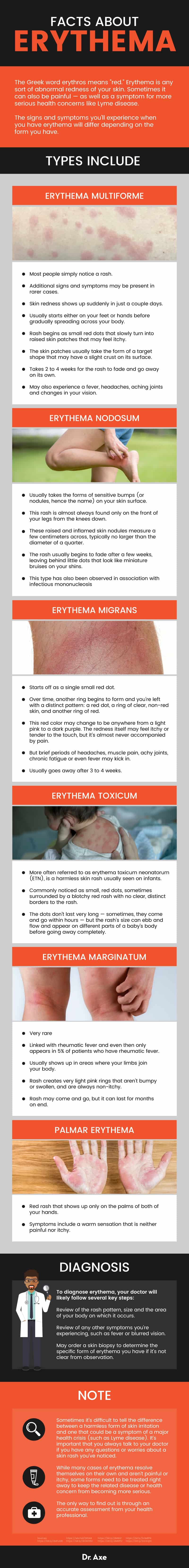 Types of erythema - Dr. Axe