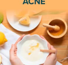 Home remedies for acne - Dr. Axe
