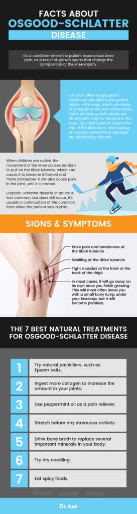 Osgood-Schlatter Disease + 7 Natural Remedies - Dr. Axe