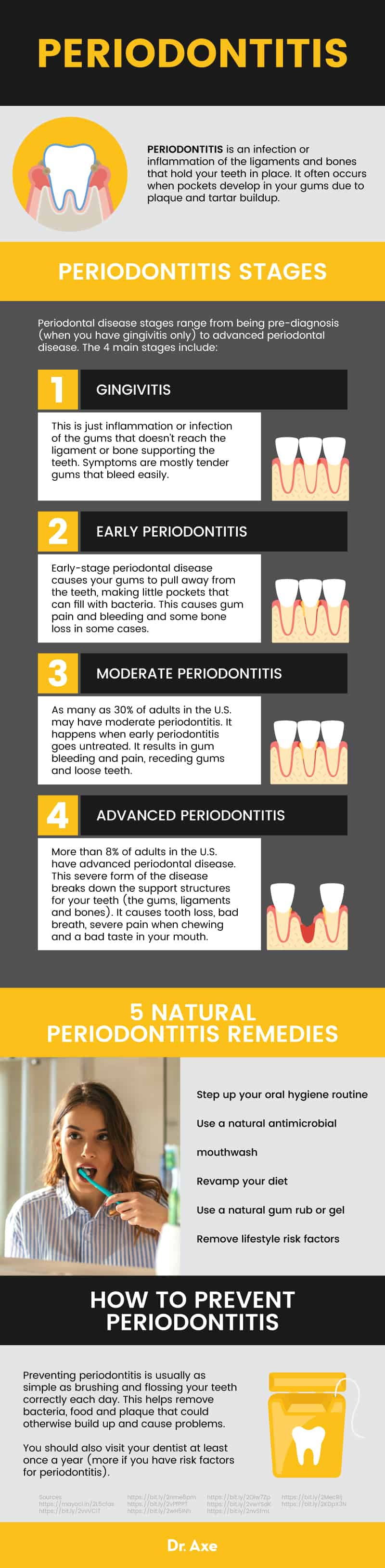 What is periodontitis? - Dr. Axe