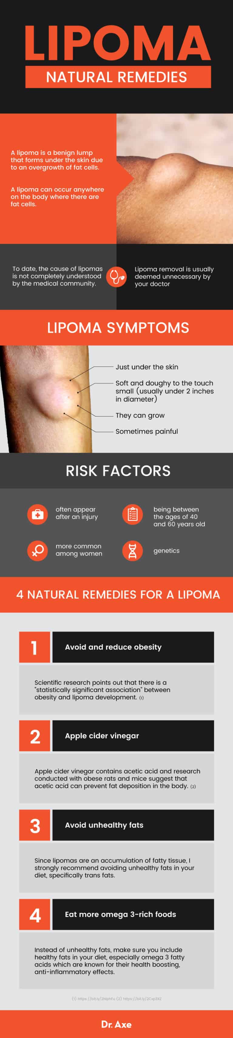 What Is a Lipoma? Symptoms, Causes + 4 Natural Remedies - Dr. Axe