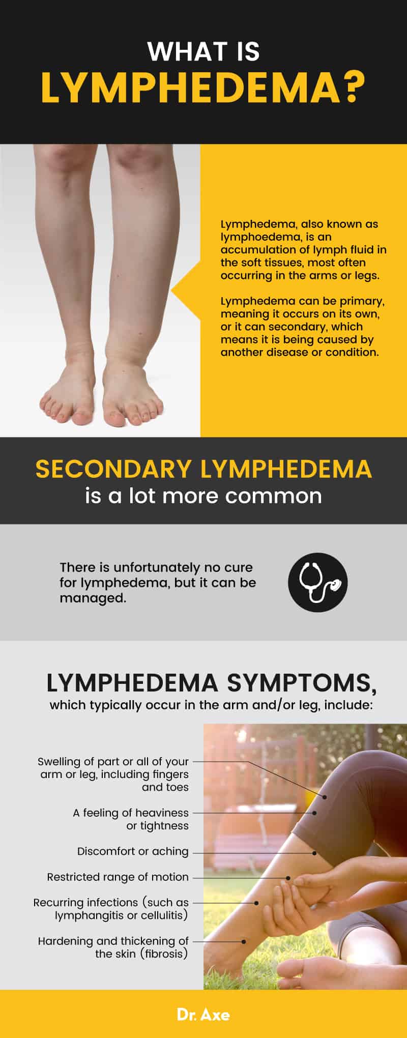 Lymphedema + 7 natural ways to manage lymphedema symptoms - Dr. Axe