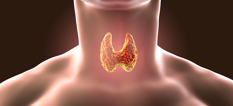 Subclinical hypothyroidism - Dr. Axe