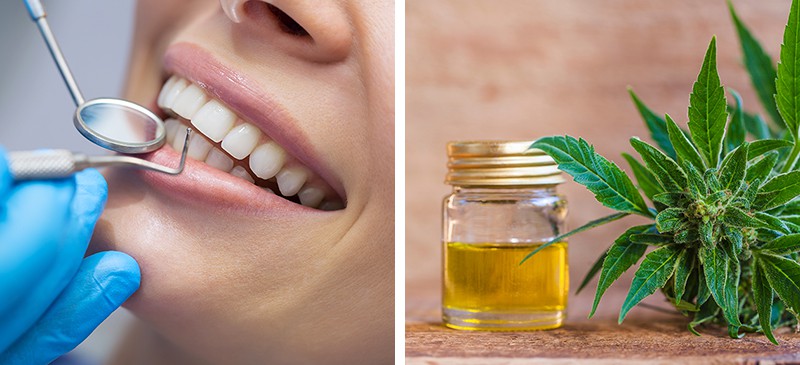CBD at the Dentist and How It May Help - Dr. Axe