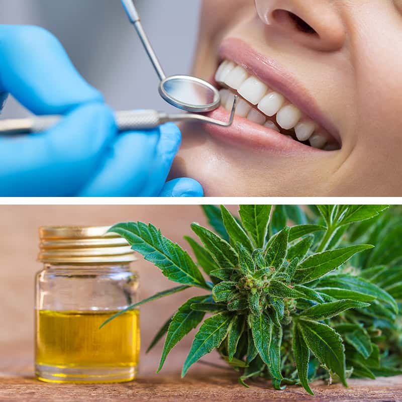 Cbd At The Dentist And How It May Help Dr Axe