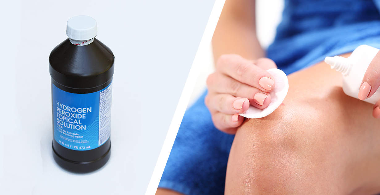 9 Unexpected Benefits of Hydrogen Peroxide 