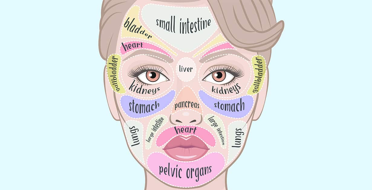 acne diagram of the face