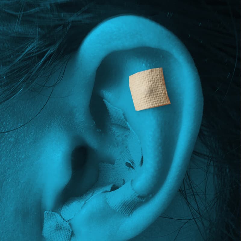 I Tried Ear Seed Acupressure For Lower Back Pain