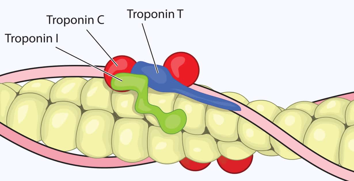 Troponin Levels What High Levels Mean Tests Normal Range Dr Axe