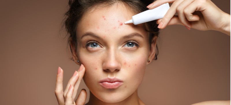 Benzoyl Peroxide For Acne Benefits Uses Side Effects And More Dr Axe