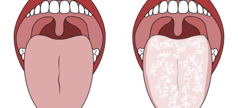 Tongue health - Dr. Axe